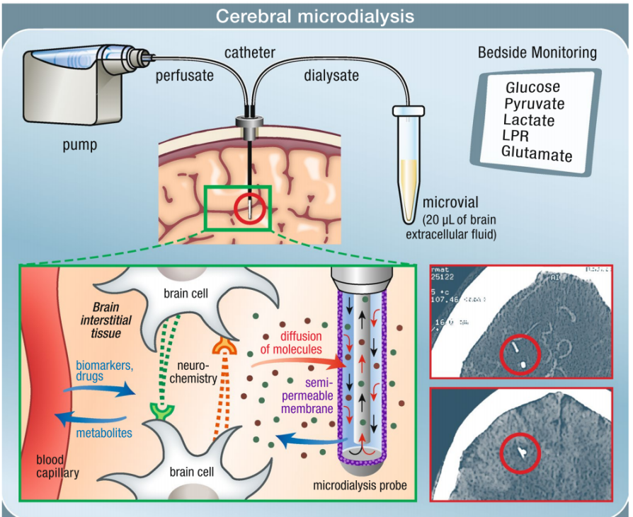 微透析技术在药代动力学研究中的应用